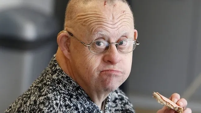 gemiddelde leeftijd syndroom van down